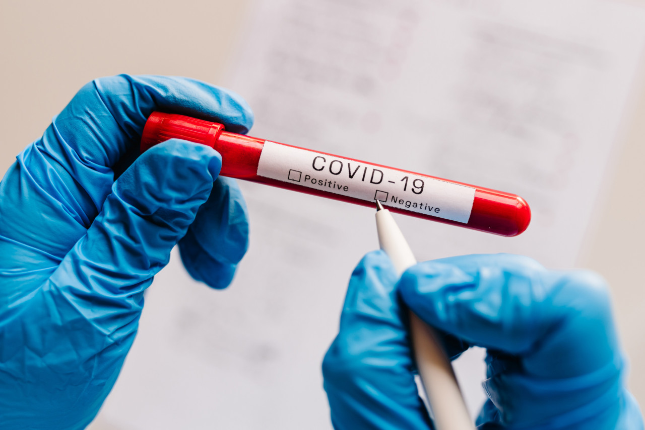 Test de dépistage du Covid-19 : personnes concernées, procédure et montant