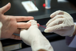 Effectuer un test de dépistage du VIH